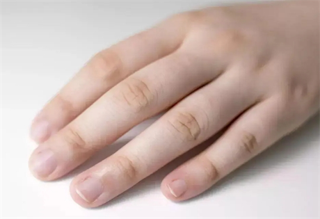 手指可分为哪几种类型?手指与人生运程有什么关系？