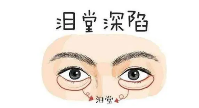 面相图解：耳后黑子，客死他乡；眼堂丰厚之人贪淫；鬼牙尖露，其人奸诈