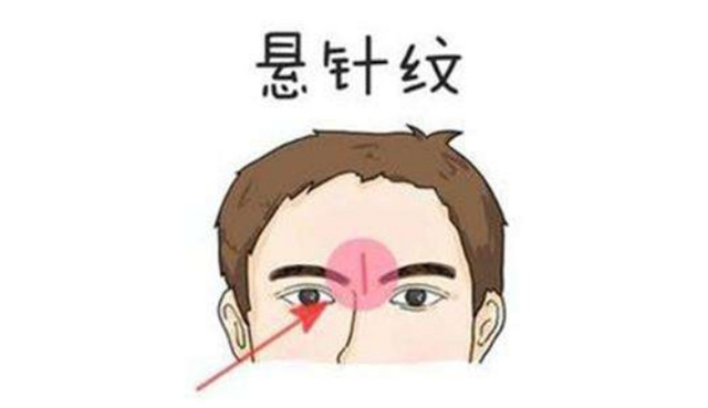 面部纹路：印堂悬针纹，鲁莽急躁；印堂双直纹，适合做企划；印堂八字纹，专门做学问