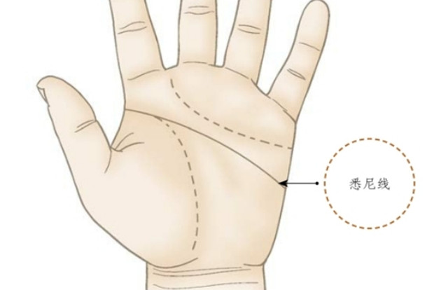 掌纹诊病：如何通过悉尼线纹路来预测人的身体健康情况